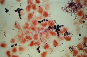 Candida glabrata