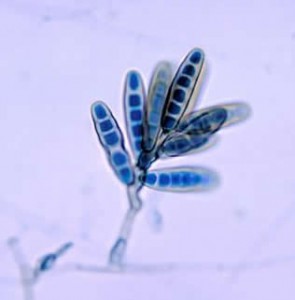 Conidiophore_of_the_fungus_Bipolaris_hawaiiensis